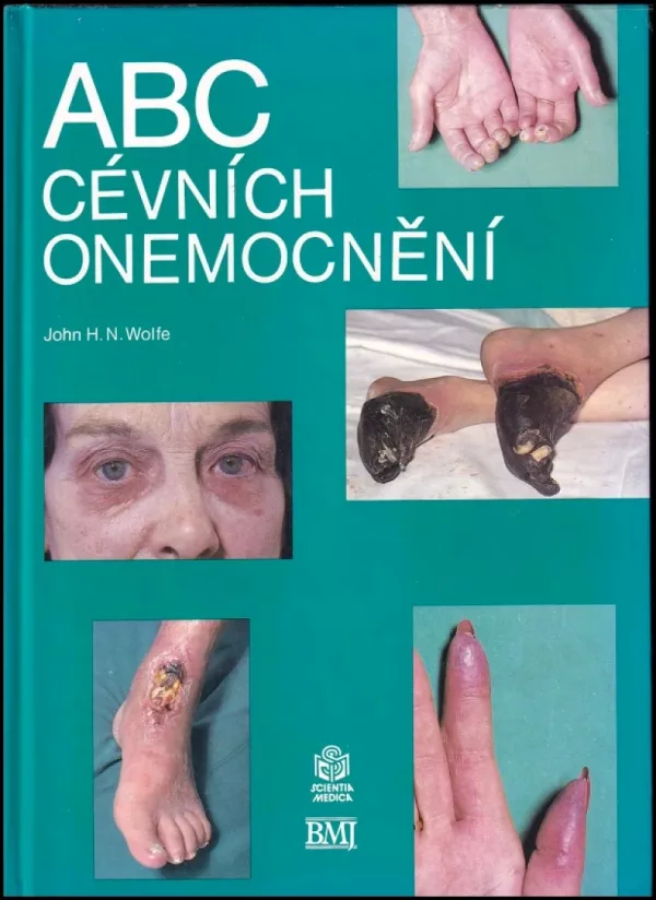 ABC cévních onemocnění