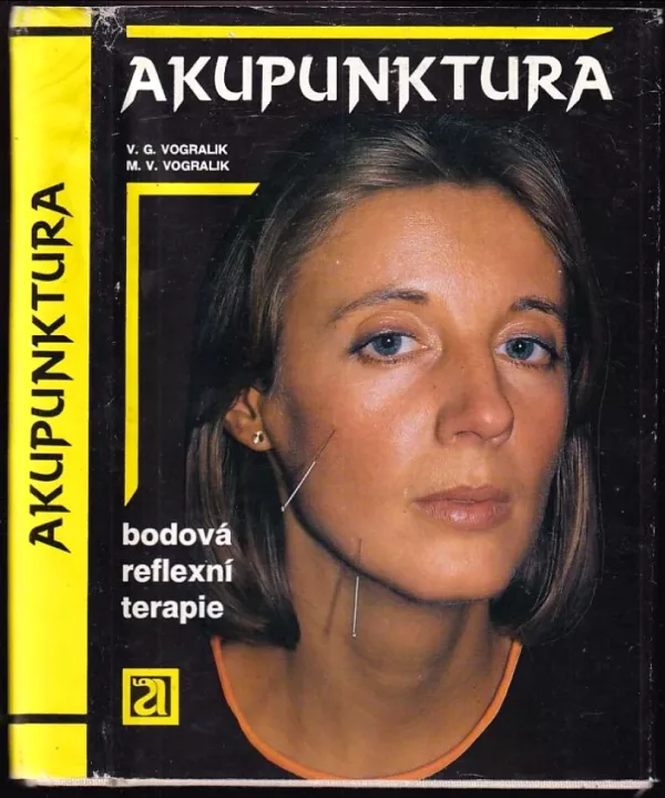 Akupunktura