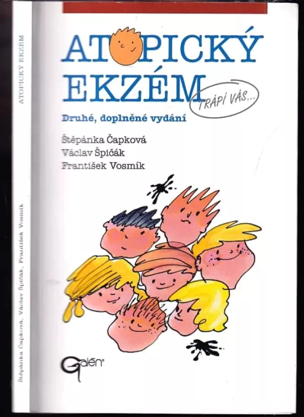 At[o]pický ekzém
