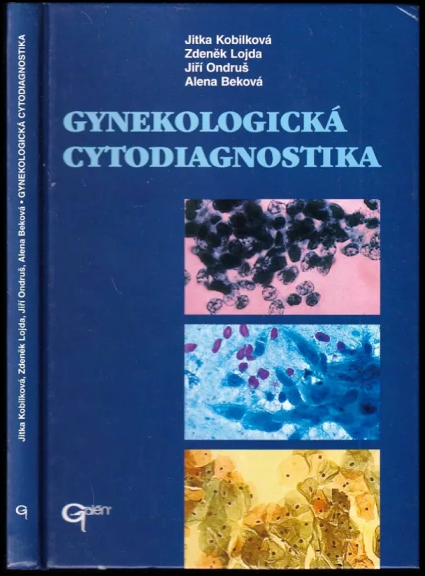 Gynekologická cytodiagnostika