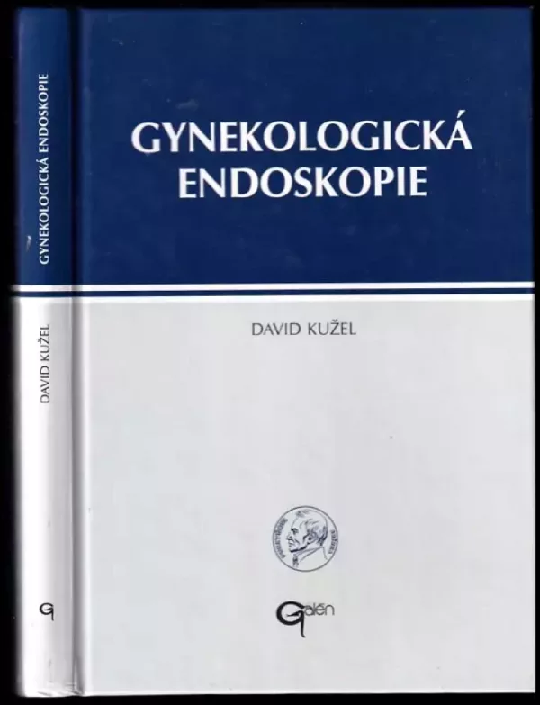 Gynekologická endoskopie