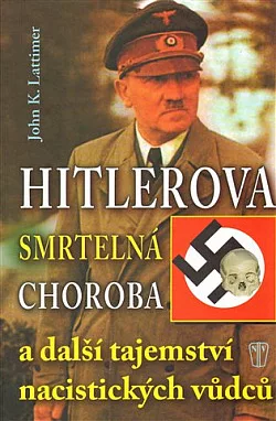 Hitlerova smrtelná choroba a další tajemství nacistických vůdců