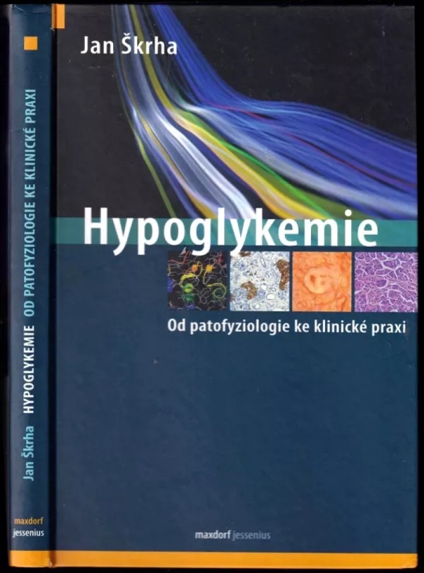 Hypoglykemie
