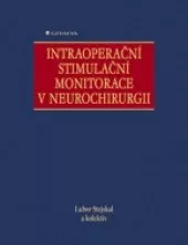 Intraoperační stimulační monitorace v neurochirurgii