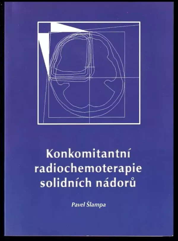 Konkomitantní chemoradioterapie solidních nádorů