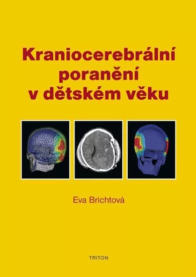 Kraniocerebrální poranění v dětském věku
