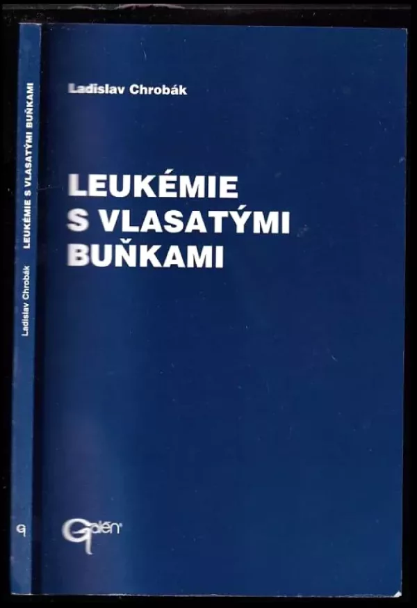 Leukémie s vlasatými buňkami
