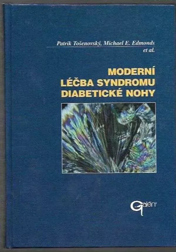 Moderní léčba syndromu diabetické nohy