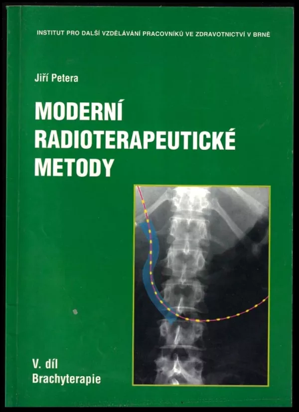 Moderní radioterapeutické metody