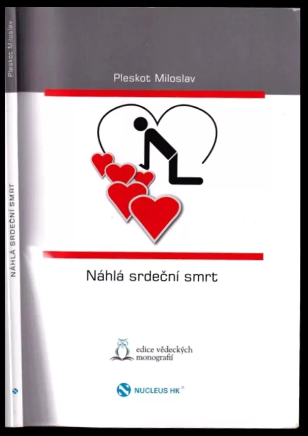 Náhlá srdeční smrt
