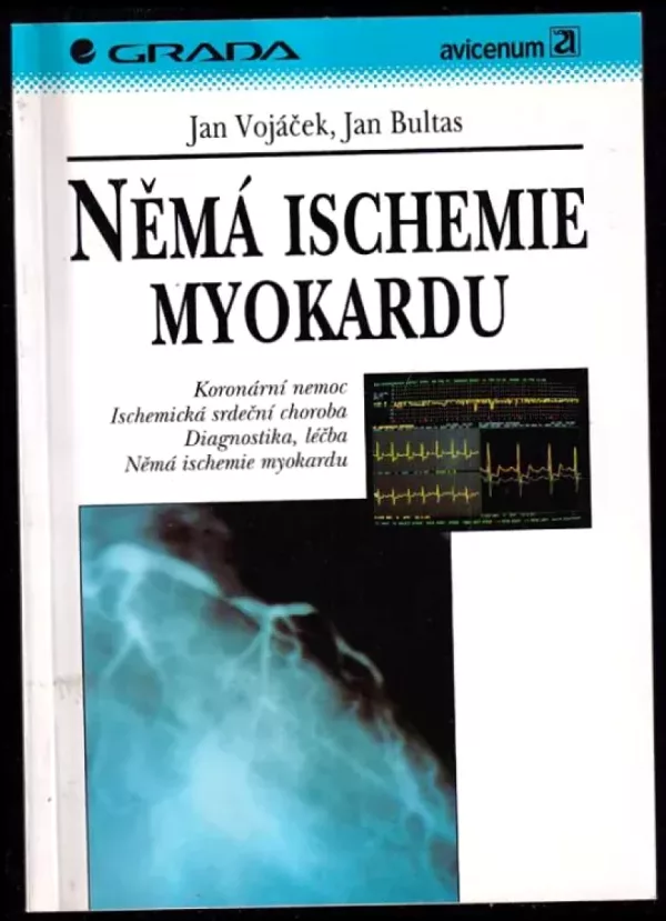 Němá ischemie myokardu