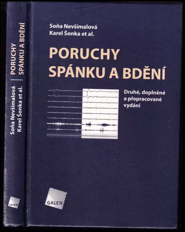 Poruchy spánku a bdění