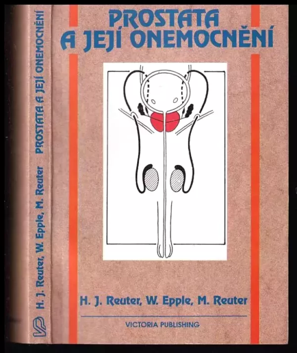 Prostata a její onemocnění : Prevence, léčba a operace, poruchy potence
