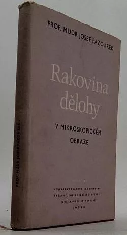Rakovina dělohy v mikroskopickém obraze