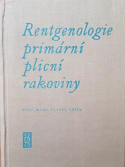Rentgenologie primární plicní rakoviny