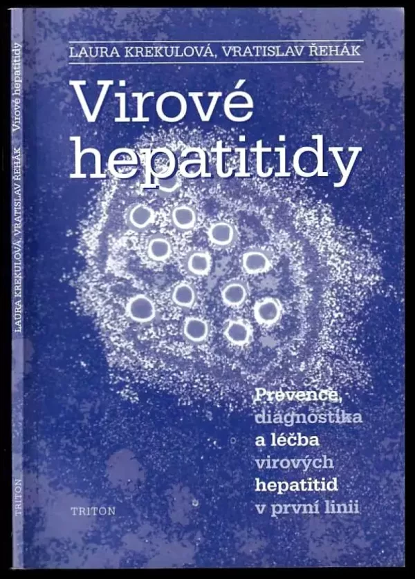 Virové hepatitidy
