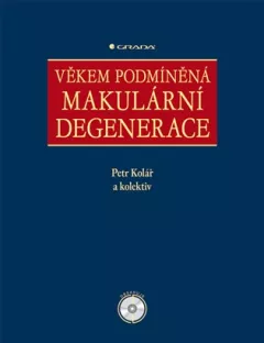 Věkem podmíněná makulární degenerace