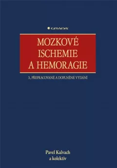 Mozkové ischemie a hemoragie