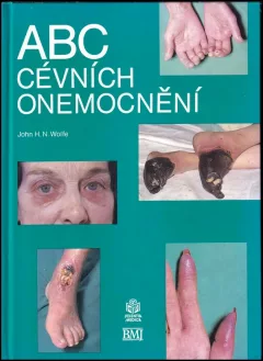 ABC cévních onemocnění