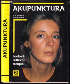 Akupunktura