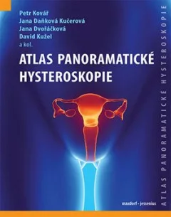 Atlas panoramatické hysteroskopie
