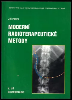 Moderní radioterapeutické metody
