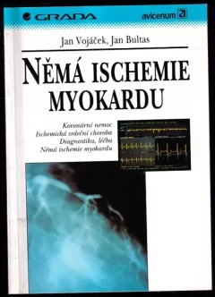 Němá ischemie myokardu