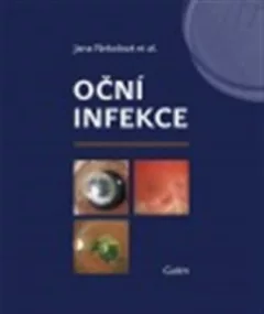 Oční infekce