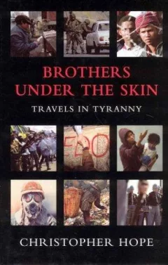 Brothers under the skin