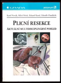 Plicní resekce : aktuální multidisciplinární pohled