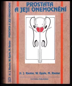 Prostata a její onemocnění : Prevence, léčba a operace, poruchy potence