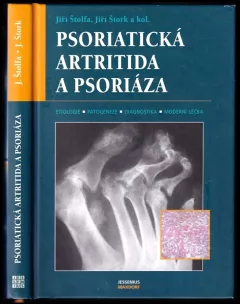 Psoriatická artritida a psoriáza