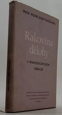 Rakovina dělohy v mikroskopickém obraze