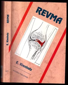 Revma