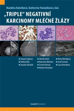 „Triple“ negativní karcinomy mléčné žlázy