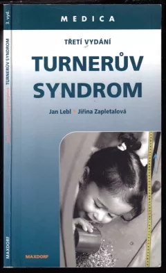 Turnerův syndrom