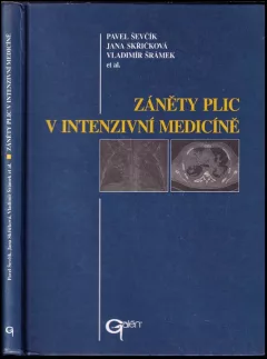 Záněty plic v intenzivní medicíně